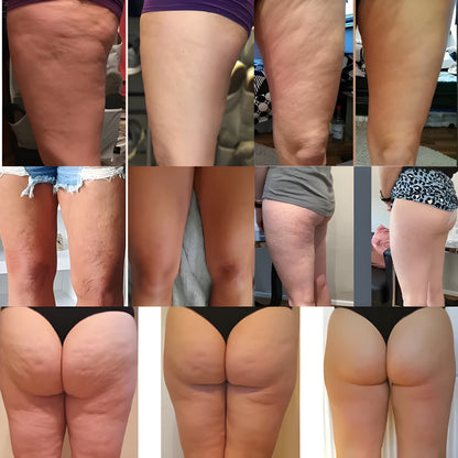 CellRoll Pro™ – für sichtbar glattere Haut